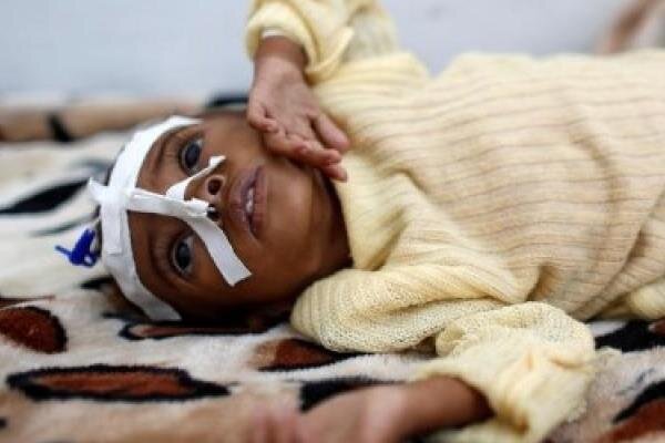 یونیسف هشدار داد: تعداد کودکان یمنی گرفتار سوءتغذیه به۲میلیون و ۴۰۰ هزار نفر می‌رسد